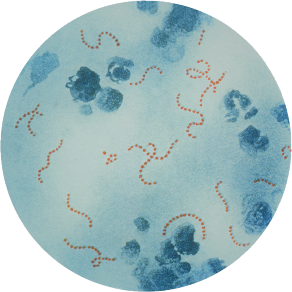 La scarlatine est une maladie infectieuse de la peau due à la bactérie Streptococcus pyogenes (vue au microscope, version colorisée).