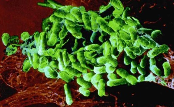 Typhus exanthématique, transmis par le pou de corps et la bactérie Rickettsia prowazekii (vue au microscope à balayage, version colorisée).